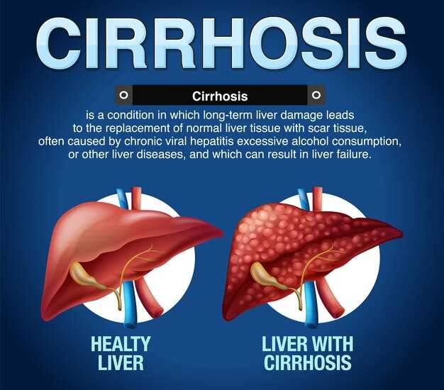 Cirrhosis Omeprazole: A Comprehensive Guide