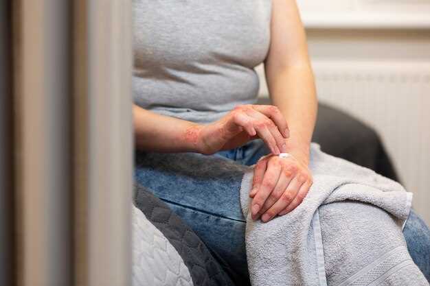 Omeprazole and joint problems