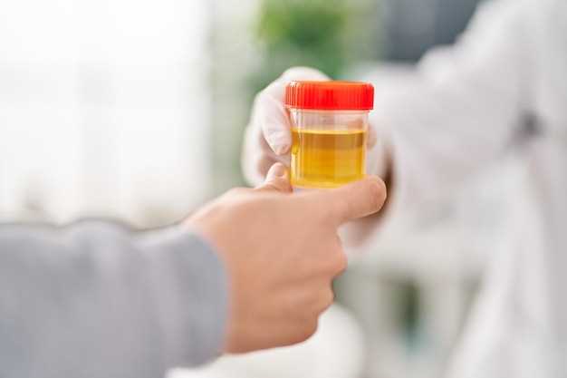 Omeprazole orange urine