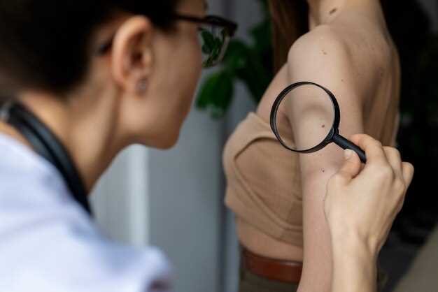 Omeprazole plavix interaction